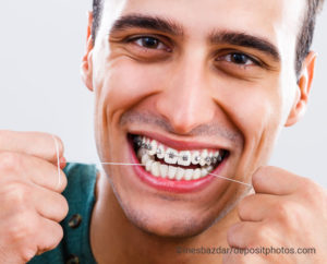Mann Brackets mit Zahnseide
