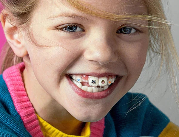 Festsitzende Zahnspange Mädchen